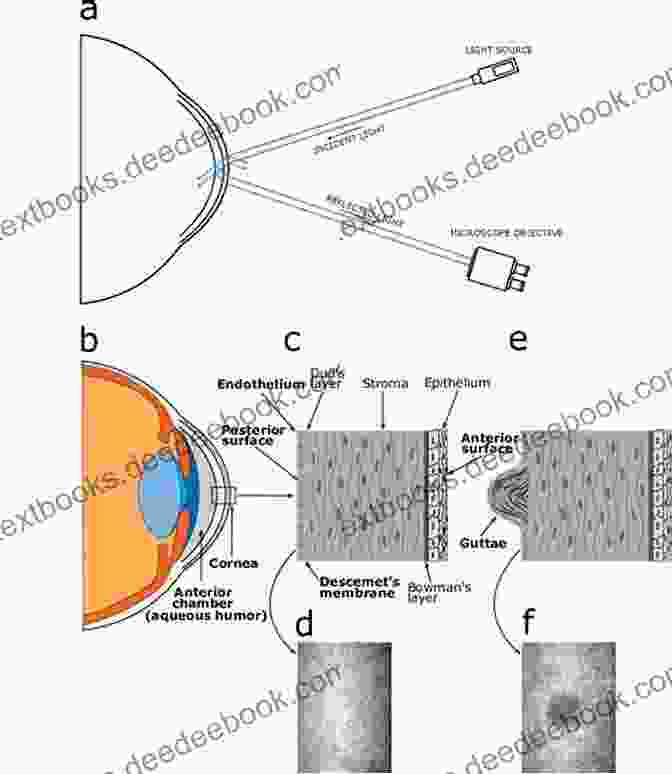Specular Microscopy Of The Cornea Light And Specular Microscopy Of The Cornea